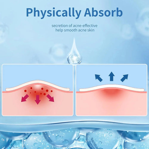 "24-Piece Hydrocolloid Acne Patches - Invisible Pimple Healing Stickers"